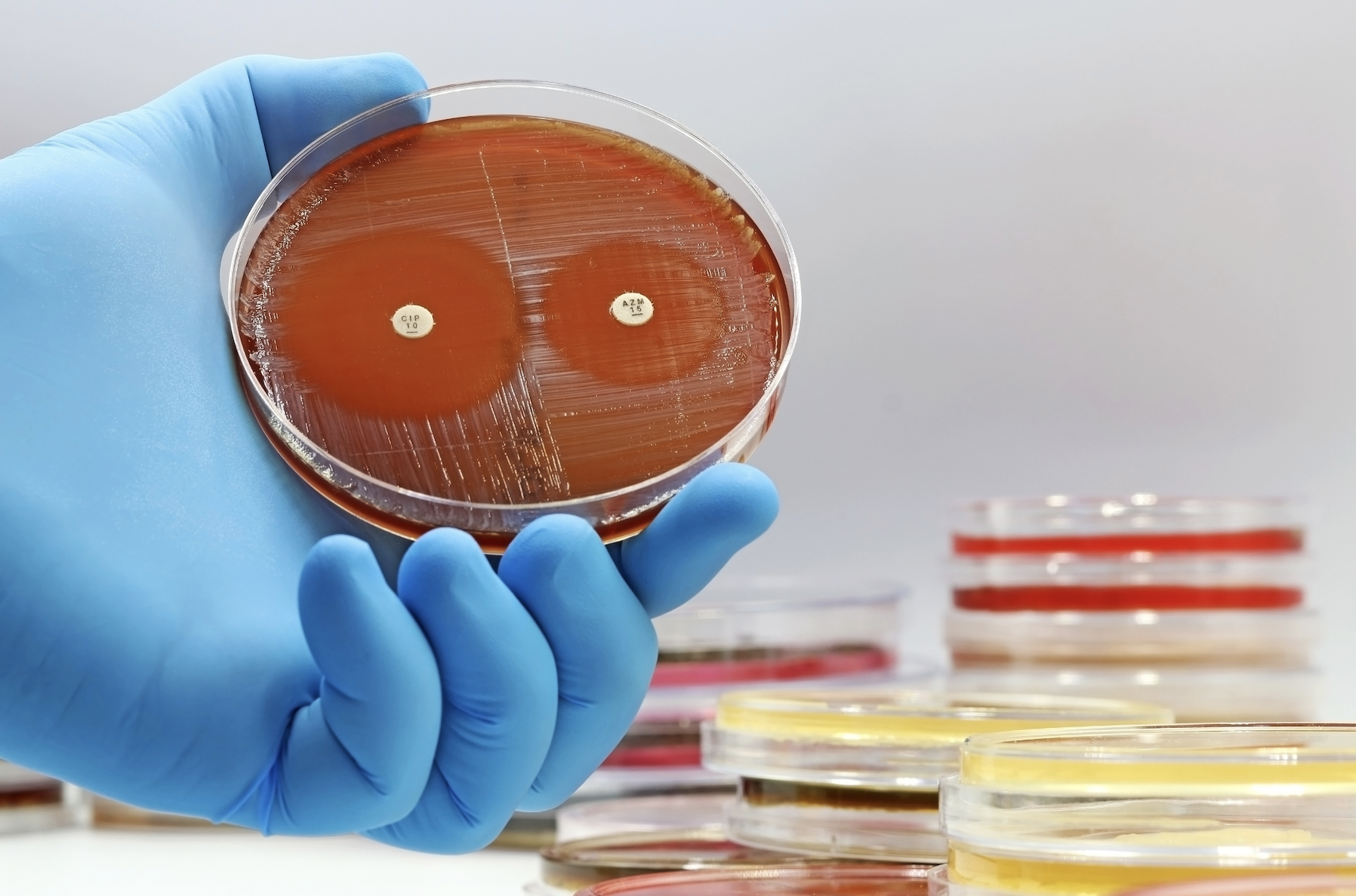 Antibiotic resistant bacteria like staphylococcus aureus requires modern medicine and prescription antibiotics to treat it. 